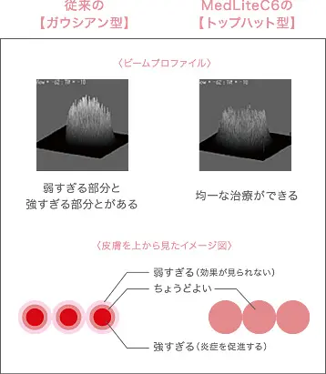 説明図