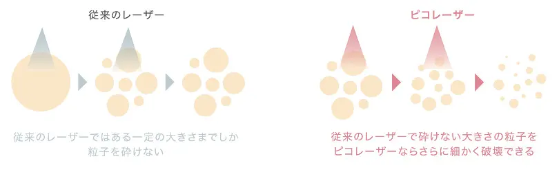 従来のレーザーとピコレーザ−の違い図