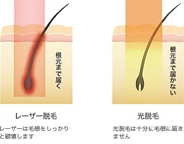 説明図